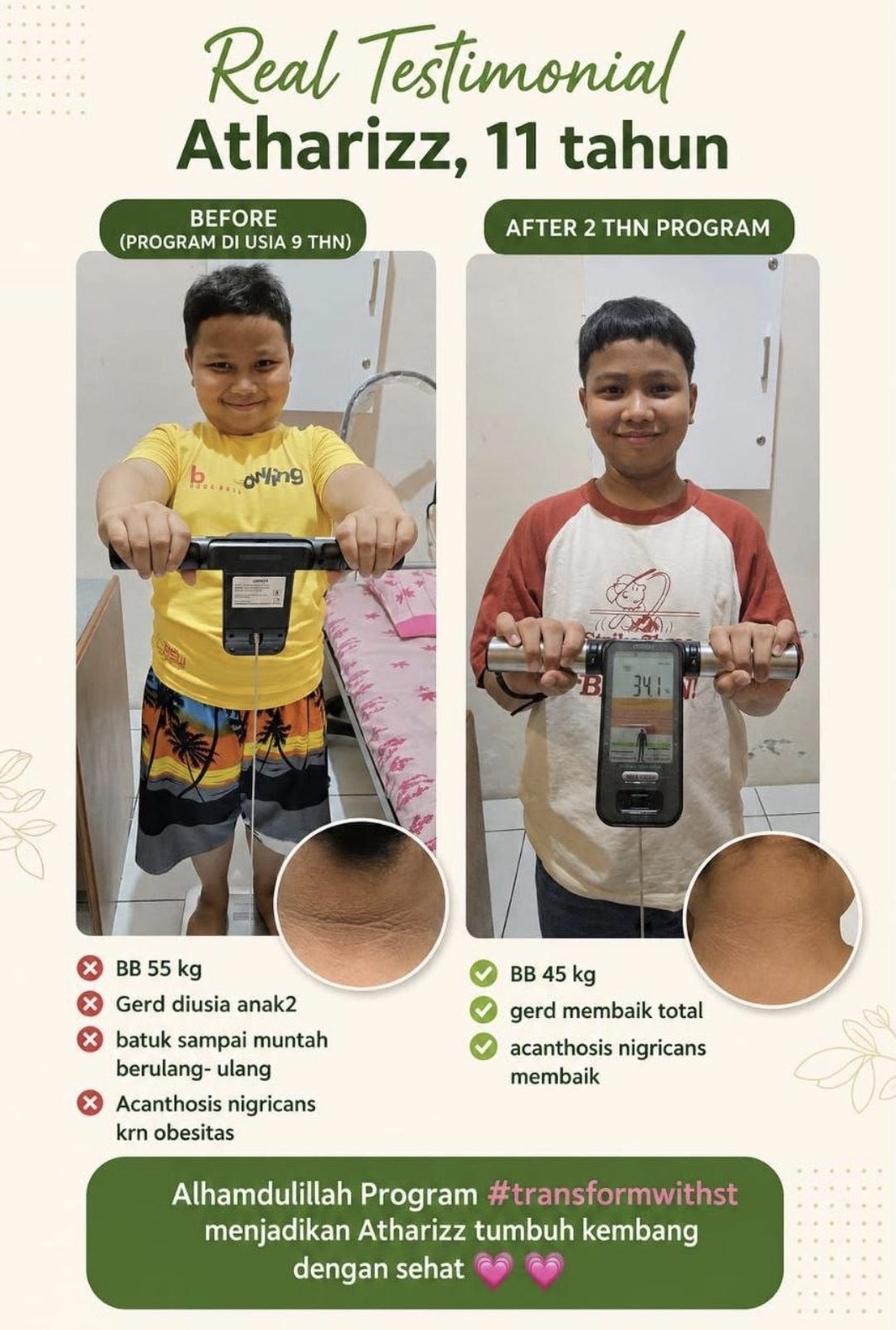 TransformwithST customer before and after transformation